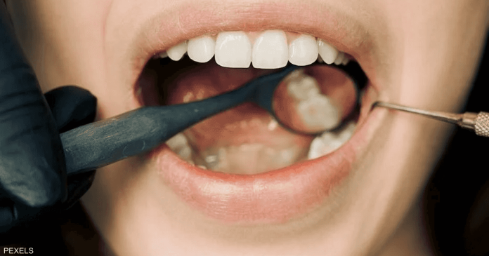 ...راقبها بعناية: 4 علامات مخيفة لسرطان الفم